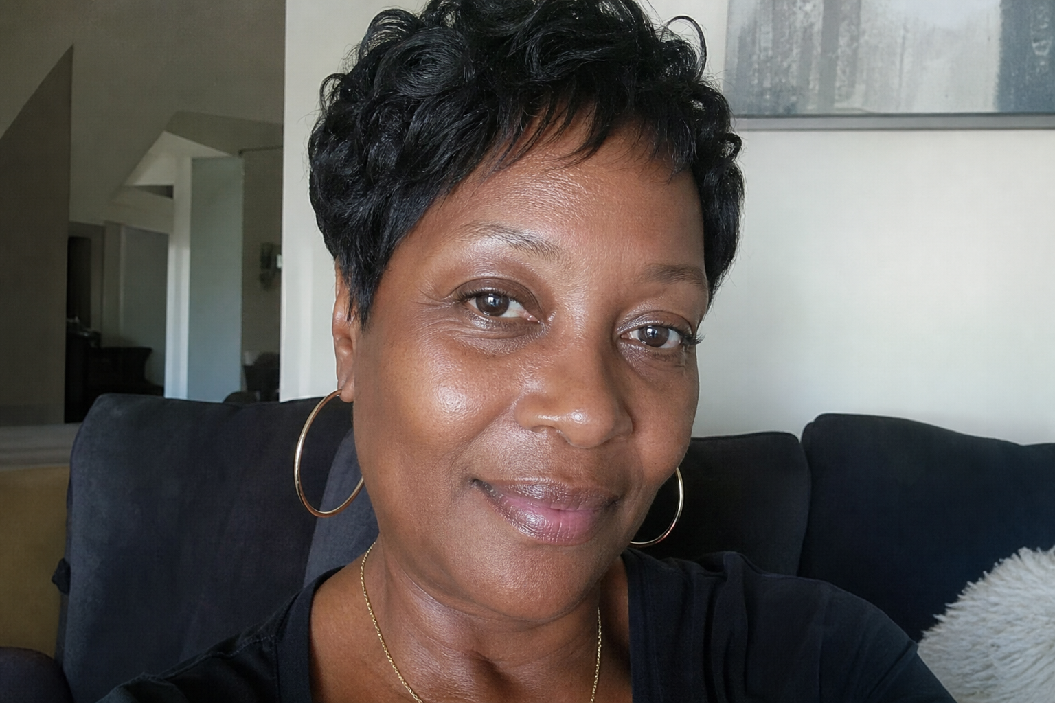 Amateur selfie of Audrey after a skin treatment plan